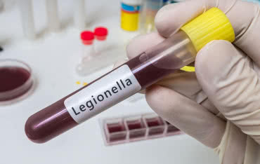 Sposoby zapobiegania bakteriom Legionella w instalacjach